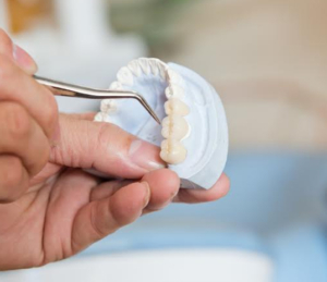 Dental Bridges in Bournemouth | Tooth Replacement | Charminster House